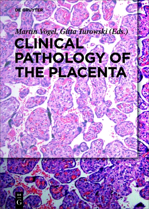 Cover image for book Clinical Pathology of the Placenta