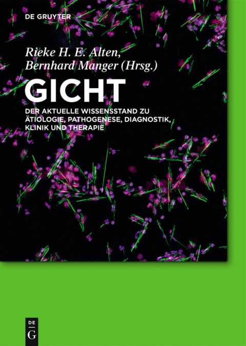 Cover image for book Gicht