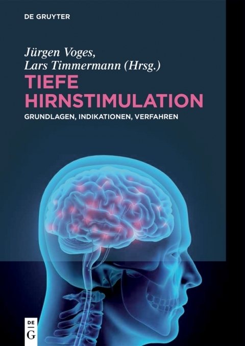 Cover image for book Tiefe Hirnstimulation