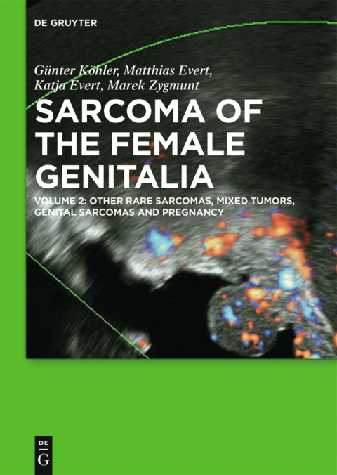 Cover image for book Other Rare Sarcomas, Mixed Tumors, Genital Sarcomas and Pregnancy