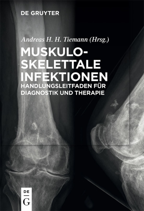 Cover image for book Muskuloskelettale Infektionen