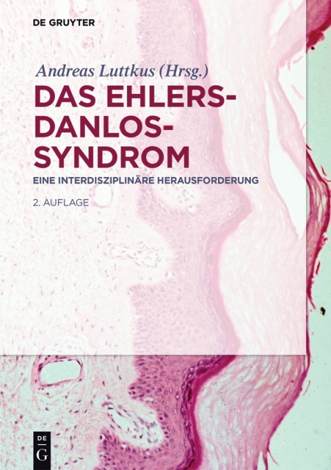 Cover image for book Das Ehlers-Danlos-Syndrom