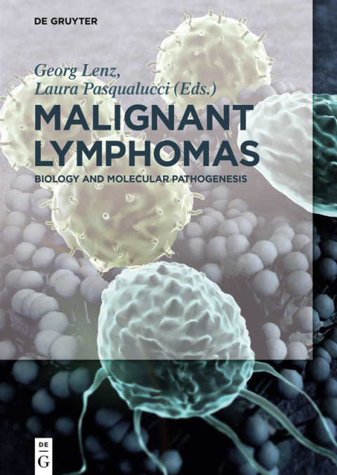 Cover image for book Malignant Lymphomas