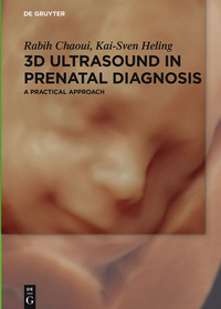 Cover image: 3D Ultrasound in Prenatal Diagnosis 1st edition 9783110496512