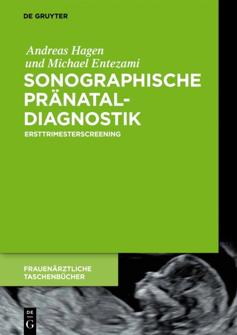 Cover image for book Sonographische Pränataldiagnostik