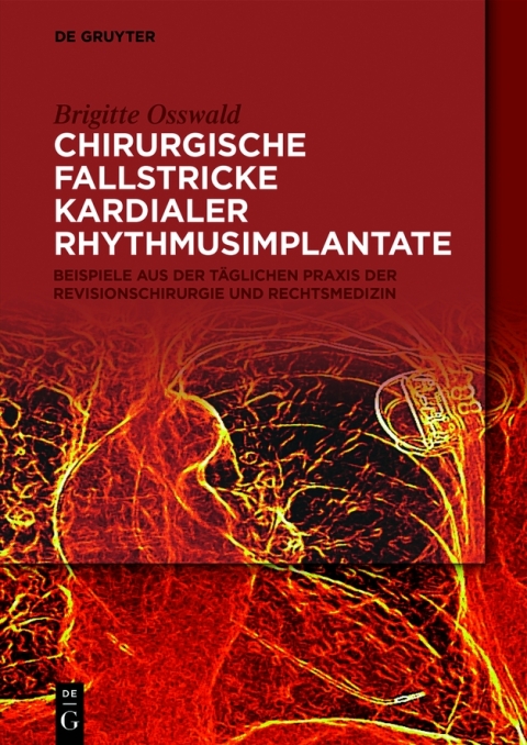 Chirurgische Fallstricke kardialer Rhythmusimplantate 
