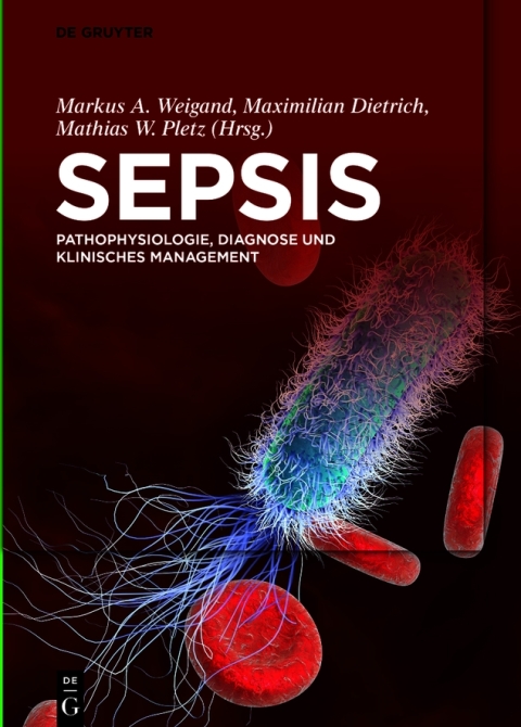 Cover image for book Sepsis