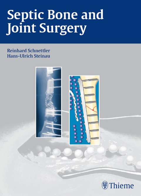 Cover image for book Septic Bone and Joint Surgery
