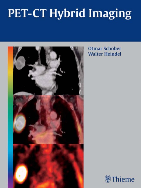 Cover image for book PET-CT Hybrid Imaging