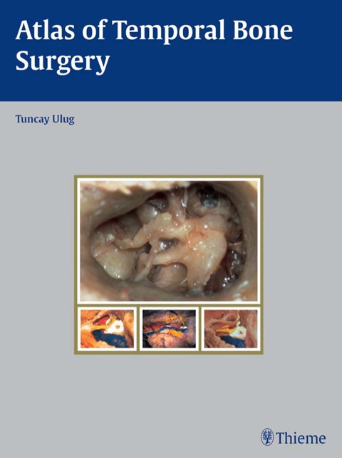 Cover image for book Atlas of Temporal Bone Surgery