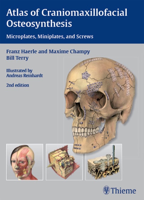 Cover image for book Atlas of Craniomaxillofacial Osteosynthesis