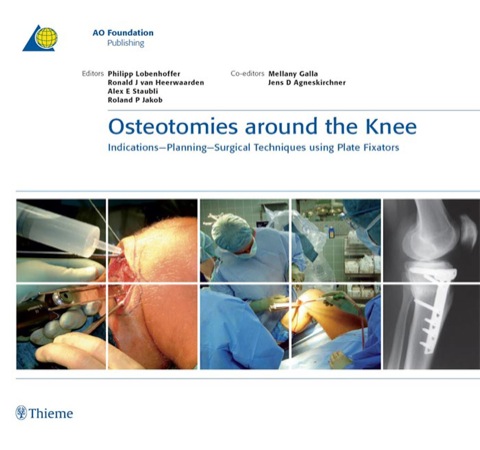 Cover image for book Osteotomies around the Knee