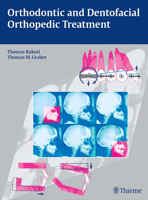 Cover image for book Orthodontic and Dentofacial Orthopedic Treatment