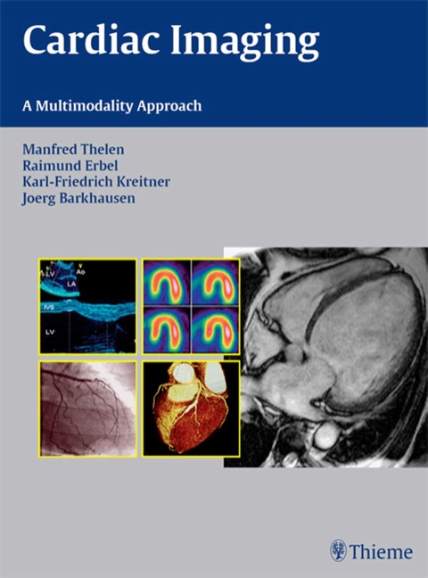 Cover image for book Cardiac Imaging