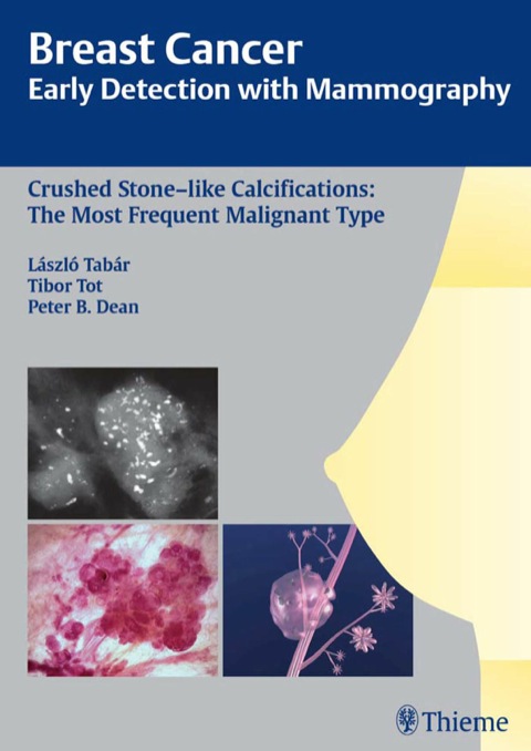 Cover image for book Breast Cancer: Early Detection with Mammography