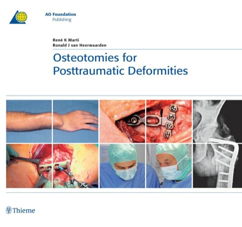 Cover image for book Osteotomies for Posttraumatic Deformities