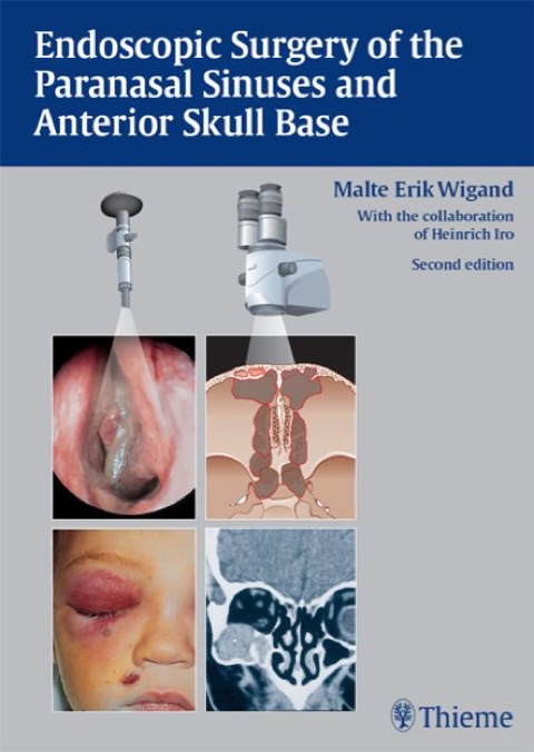 Cover image for book Endoscopic Surgery of the Paranasal Sinuses and Anterior Skull Base