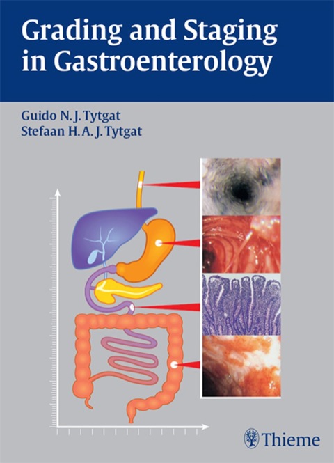Cover image for book Grading and Staging in Gastroenterology