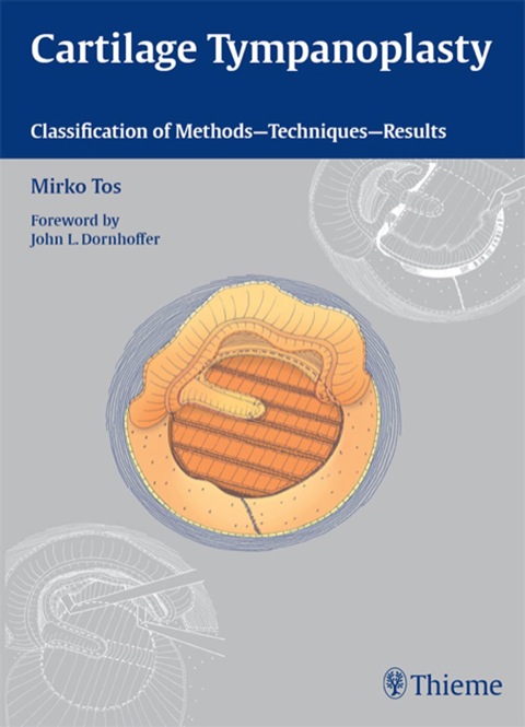 Cover image for book Cartilage Tympanoplasty