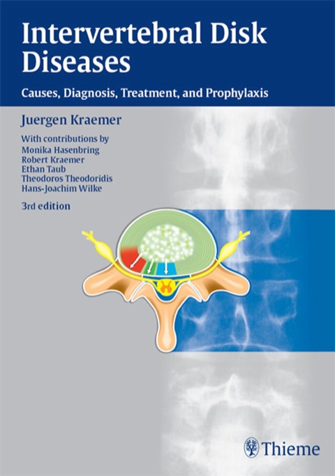 Cover image for book Intervertebral Disk Diseases