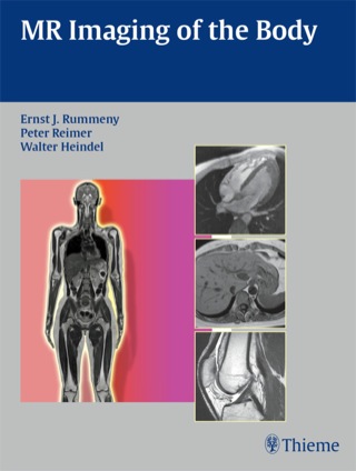 MR Imaging of the Body