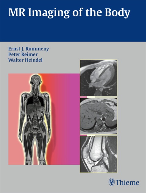 Cover image for book MR Imaging of the Body