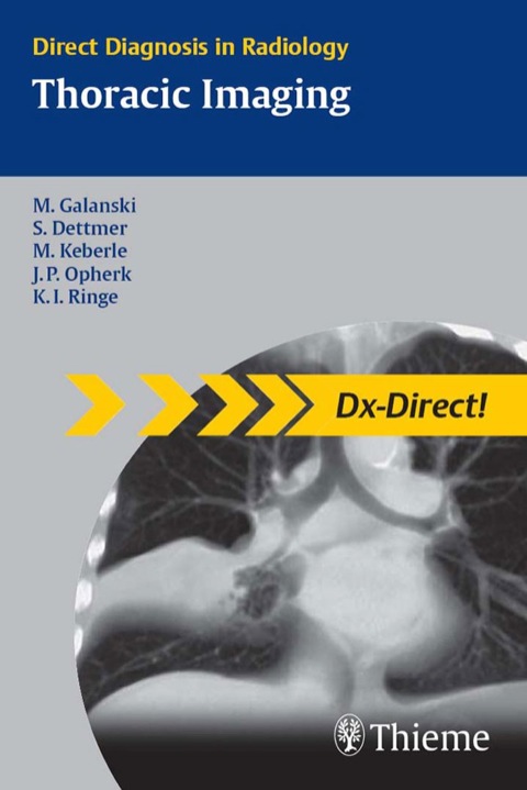 Cover image for book Thoracic Imaging