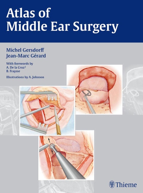 Cover image for book Atlas of Middle Ear Surgery