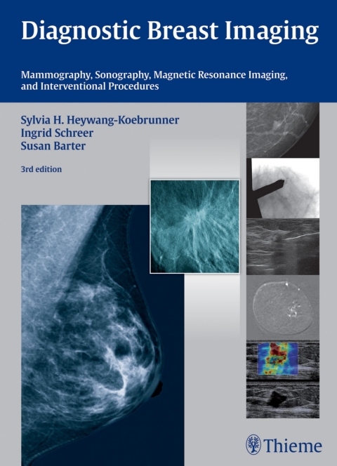 Cover image for book Diagnostic Breast Imaging