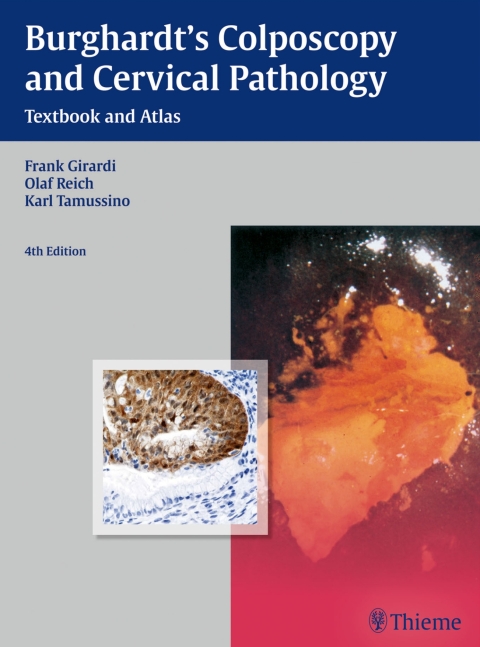 Cover image for book Burghardt's Colposcopy and Cervical Pathology