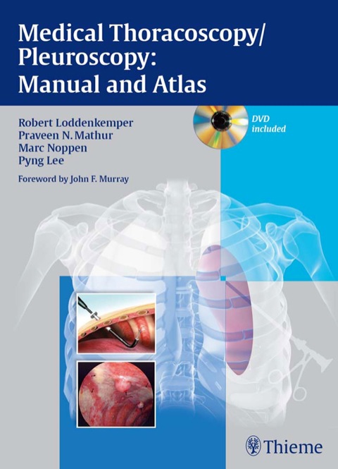 Cover image for book Medical Thoracoscopy / Pleuroscopy