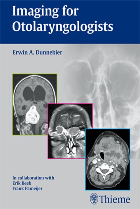 Cover image for book Imaging for Otolaryngologists