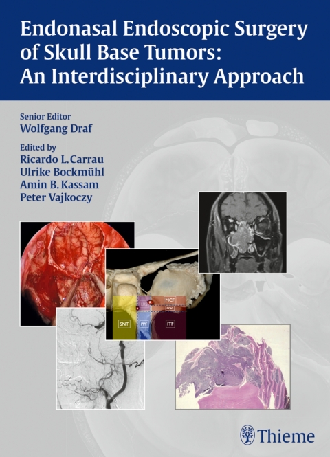 Cover image for book Endonasal Endoscopic Surgery of Skull Base Tumors: An Interdisciplinary Approach