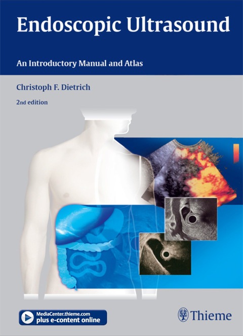 Cover image for book Endoscopic Ultrasound