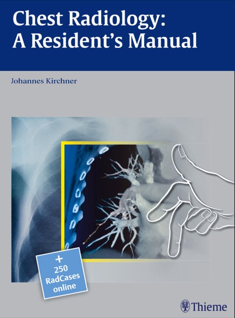 Cover image for book Chest Radiology