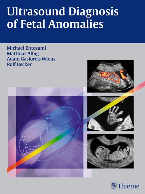Cover image for book Ultrasound Diagnosis of Fetal Anomalies