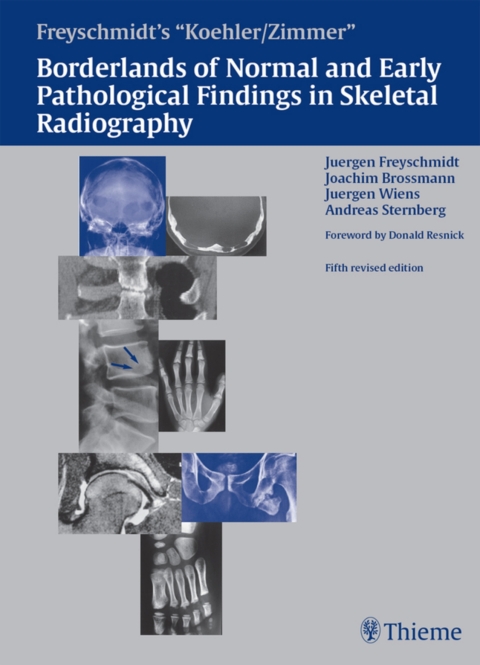Cover image for book Freyschmidt's "Koehler/Zimmer" Borderlands of Normal and Early Pathological Findings in Skeletal Radiography