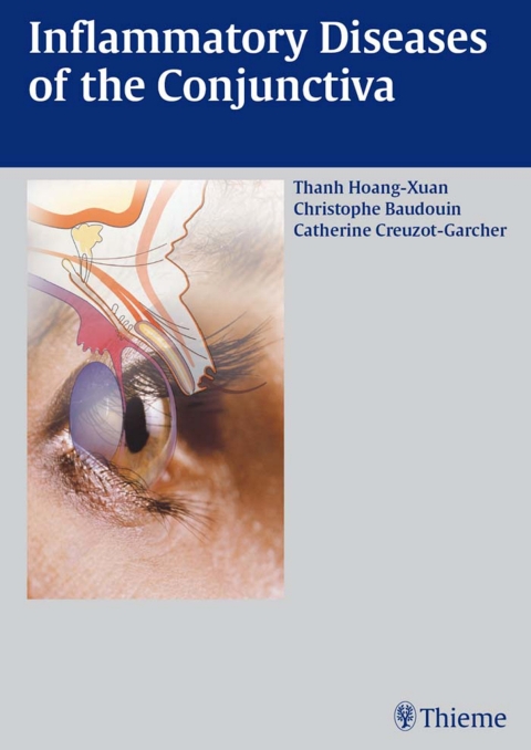 Cover image for book Inflammatory Diseases of the Conjuctiva
