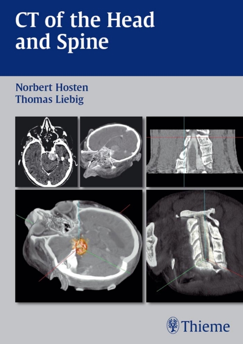 Cover image for book CT of the Head and Spine