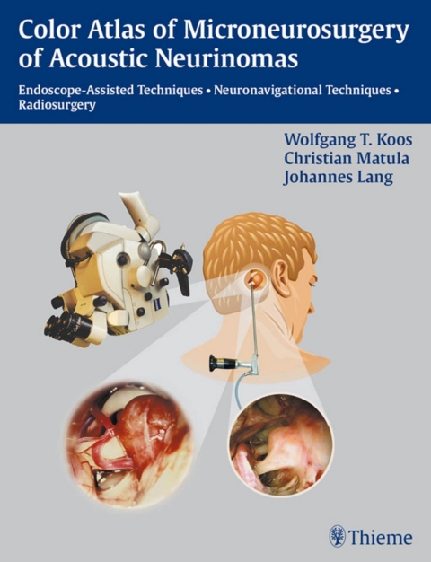 Cover image for book Color Atlas of Microsurgery of Acoustic Neurinomas