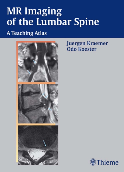 Cover image for book MR Imaging of the Lumbar Spine