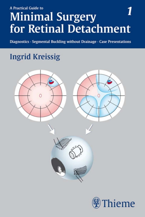 Cover image for book A Practical Guide to Minimal Surgery for Retinal Detachment, Vol. 1