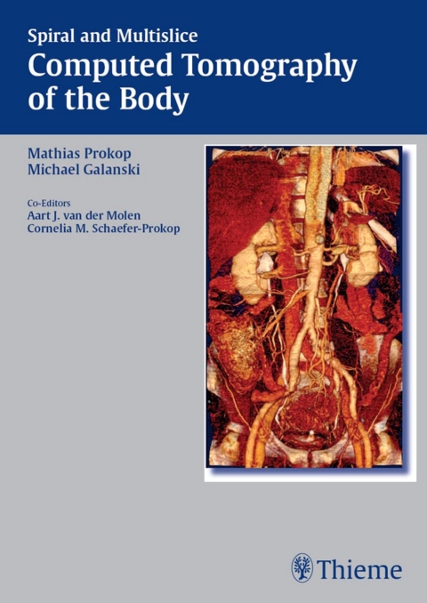 Cover image for book Spiral and Multislice Computed Tomography of the Body