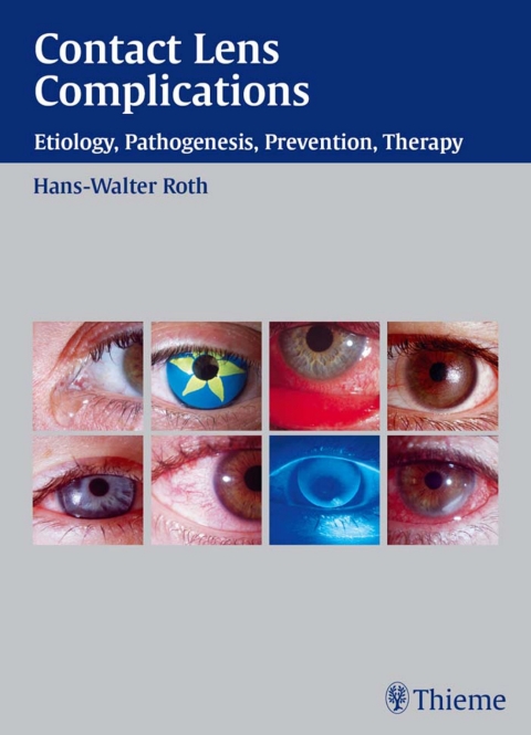 Cover image for book Contact Lens Complications