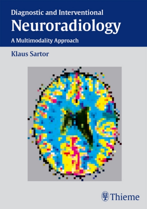 Cover image for book Diagnostic and Interventional Neuroradiology