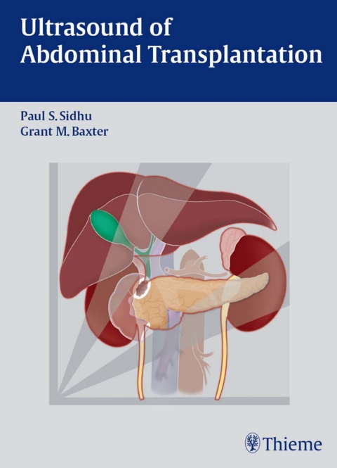 Ultrasound of Abdominal Transplantation 