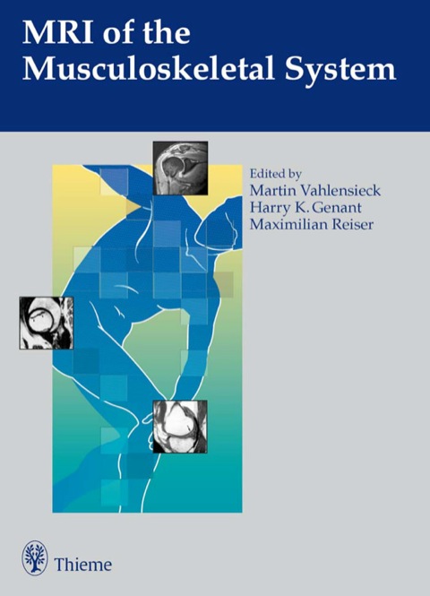 Cover image for book MRI of the Musculoskeletal System