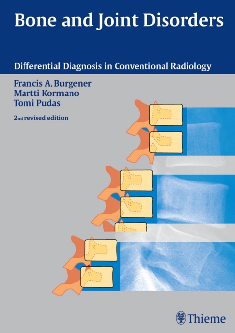 Cover image for book Bone and Joint Disorders
