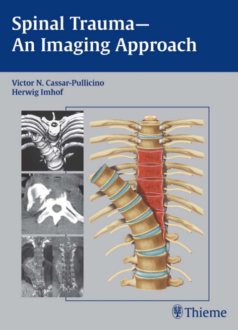 Cover image for book Spinal Trauma - An Imaging Approach