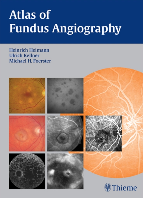 Cover image for book Atlas of Fundus Angiography